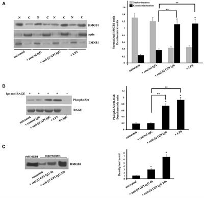 Alarmin HMGB1 and Soluble RAGE as New Tools to Evaluate the Risk Stratification in Patients With the Antiphospholipid Syndrome